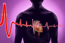 Hormon Seks Wanita yang Tinggi Berisiko Picu Serangan Jantung Mendadak