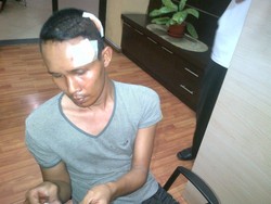 Mengaku Dipukuli Satpol PP, Pedagang Kaki Lima Lapor Polisi