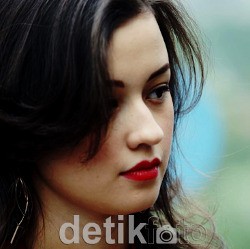 Rambut Tipis Jadi Masalah Rumit Bagi Kimberly Ryder