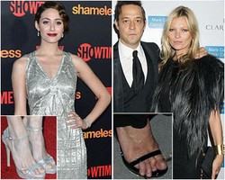 Salah Pakai High Heels, Kaki Para Seleb Ini Terlihat Mengerikan