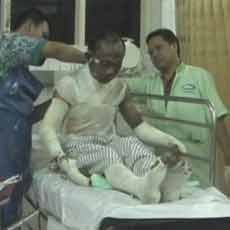 Kios Bensin Meledak, Lima Orang Sekeluarga Alami Luka Bakar