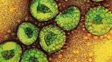 Virus Mirip SARS Renggut 18 Nyawa di Arab Saudi