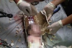 Dibuang di Saluran Toilet, Bayi Malang di China Ditemukan Selamat