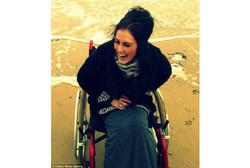 Kena Gangguan Langka, Model Ini Justru Pingsan Tiap Kali Berdiri