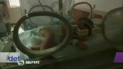 Kondisi Bayi Dibuang ke WC Makin Sehat