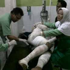 Seorang Mahasiswa Nekat Bakar Diri Gara-gara Putus Cinta