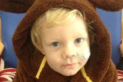 Kisah Bocah 18 Bulan yang Melepuh dan Hampir Meninggal Akibat Bakteri