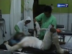 Putus Cinta, Mahasiswa Bakar Diri