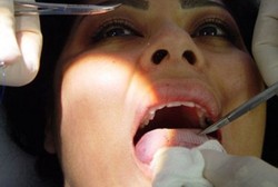 Diet Ekstrem, Jahit Lidah dengan Koyo Plastik Agar Susah Makan