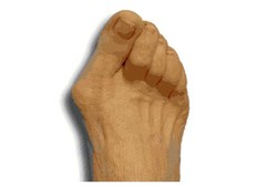 Jempol Kaki Bengkok? Hindari Pakai Sepatu Hak Tinggi Berujung Lancip