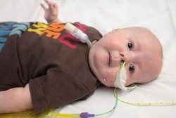 Kisah April, Bayi 6 Bulan yang Melawan Penyakit Langka Emanuel Syndrome