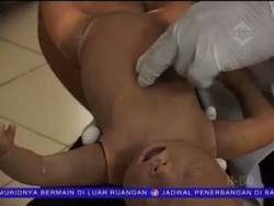 Tersedak Biji Bakso, Balita 3 Tahun Tewas Mengenaskan