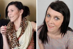 Umur 16 Tahun Tapi Wajah 60 Tahun, Zara Jalani Operasi Perintis