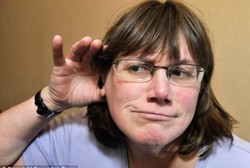 Wanita Bertelinga Super, Bisa Dengar Suara Organ Tubuh Sendiri