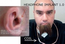 Rich Lee, Manusia Pertama yang Cangkok Headphone di Telinganya