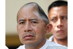 Kisah Antonio Lopez Chaj, Pria yang Kehilangan Seperempat Kepala