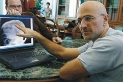 Obati Penyakit Parah, Ilmuwan Italia Bisa Pasang Kepala ke Tubuh Lain