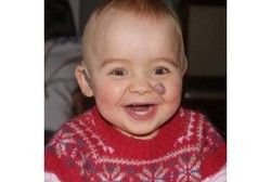 Kisah Allegra, Bayi Prematur dengan Gangguan Pendengaran