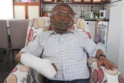 Demi Stop Merokok, Pria Ini Rela Kerangkeng Kepalanya