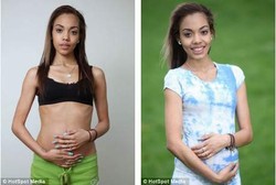 Gara-gara Anoreksia, Hamil 8 Bulan Berat Badan Holly Cuma 51 Kg