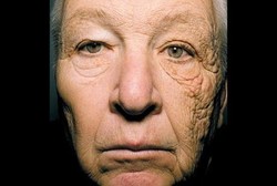 Sinar Matahari Membuat Wajah Kiri Sopir Lebih Tua dari yang Kanan