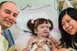 Gadis Cilik yang Terlahir Tanpa Tenggorokan Ini Akhirnya Meninggal