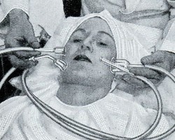 Alat-alat Aneh untuk Perawatan Kecantikan Wanita Zaman Dulu