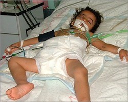 Pintu Rafah Ditutup, Nyawa 360 Pasien di Gaza Terancam