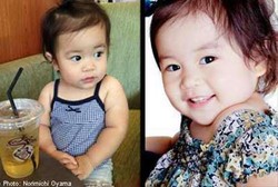  Di Usia 1,5 Tahun Donorkan Ginjal, Hanano Jadi Pendonor Organ Termuda