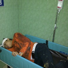 Seorang Pemuda Gegar Otak Jadi Korban Curanmor