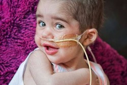 Blair, Bayi Pertama di Dunia yang Hidup dengan Jantung Bertenaga Baterai