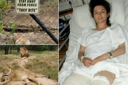 ABG Kanada Masih Hidup Setelah Digigit Singa Afrika