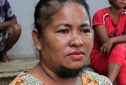 Agustina Dorman, Wanita Asal Kepri yang Berjenggot Pasca Melahirkan