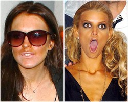 Foto: Para Selebriti dengan Hasil Tanning yang Tidak Merata