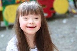 Ilmuwan Klaim Temukan Metode Atasi Downs Syndrome