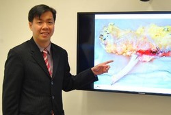 Diabetes dan Gagal Ginjal Sembuh Lewat Cangkok Pankreas dan Ginjal