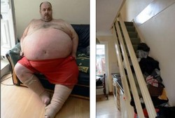 Terlalu Gemuk, Pria Ini Tak Bisa Masuk ke Kamarnya Sendiri