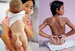 Manusia-manusia Bertubuh Monyet, Ada Ekor di Tubuhnya