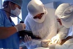 Kurang Dana, Dokter Gunakan Bor Listrik Rumahan untuk Operasi Pasien