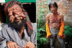 Orang-orang Bermuka Seram, Wajah Meleleh Hingga Manusia Gelembung