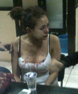 Polisi Masih Dalami Kasus Dugaan Penganiayaan Nikita Mirzani