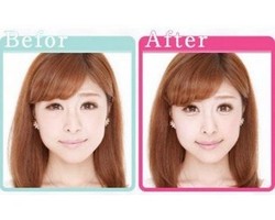 Waduh, Kantung Mata Jadi Simbol Kecantikan?