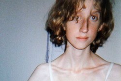 Terobsesi Jadi Pebalet, 10 Tahun Anna Berjuang Lawan Anoreksia