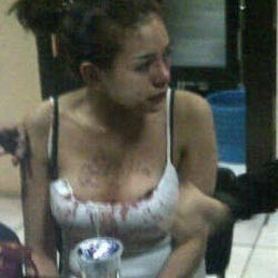 Nikita Mirzani Babak Belur, Onadio Masih Trauma