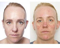 Ini Penampilan Wajah Bila Malas Membersihkan Makep-up Sebelum Tidur