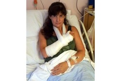  Diserang Kucing, Perempuan Ini Harus Dirawat Berhari-hari di RS