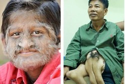 5 Orang Bertubuh Hewan, Manusia Serigala Hingga Manusia Gurita