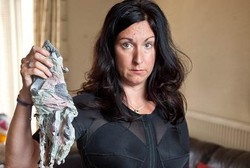 Berkat Pakaian Renang, Wanita Ini Selamat dari Luka Bakar Parah