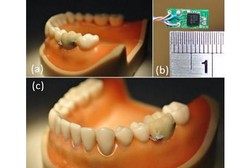 Gigi Berteknologi Wi-Fi Bisa Bantu Mencegah Makan Berlebih