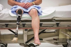 Anggota Tubuh Palsu Paling Aneh, Kelamin Palsu Hingga Lengan Gurita